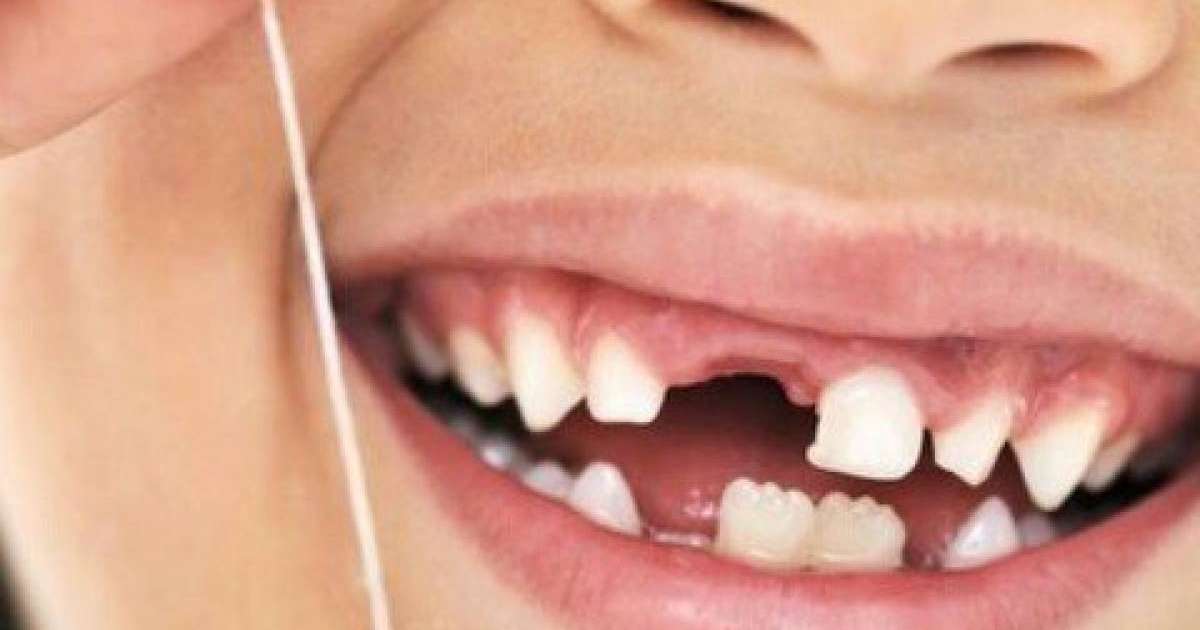 Сәбидің тісі тез шығу үшін