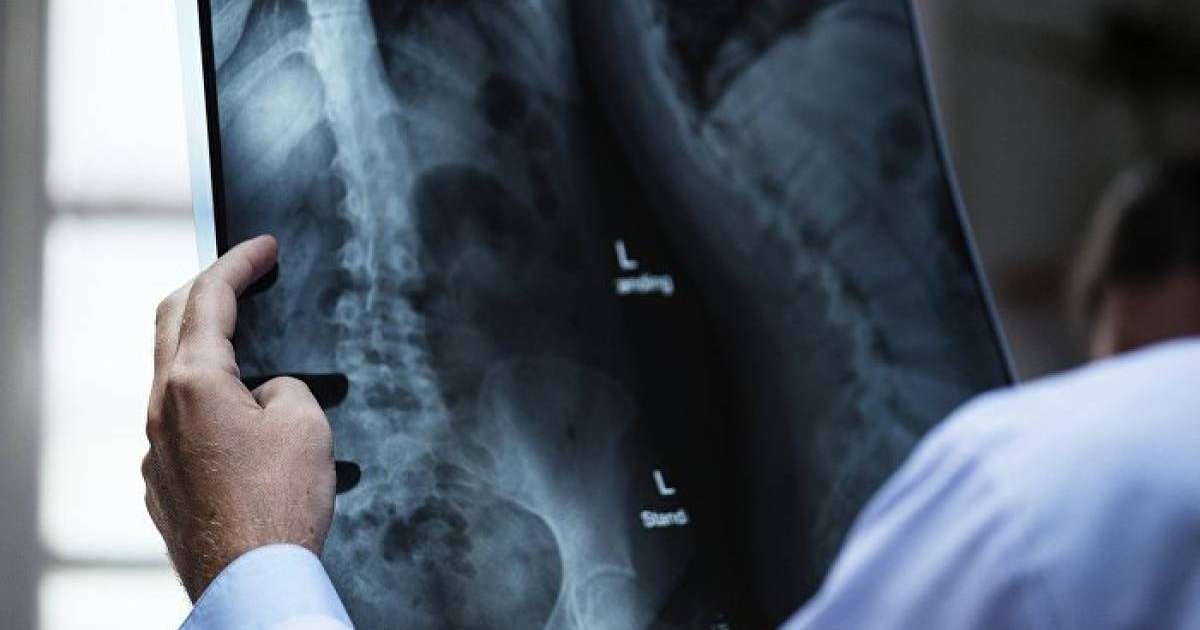 Ғалымдар бел мен мойынның ауыруы қауіпті аурудың белгісі екенін айтты