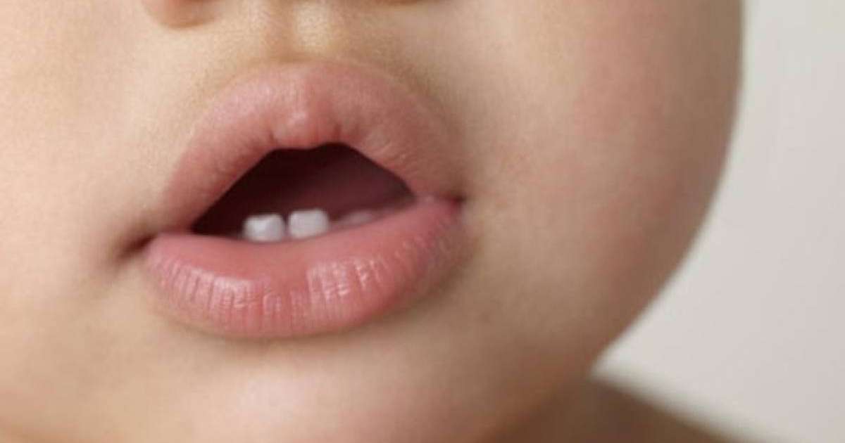 БАЛАНЫЗҒА ТІС ШЫҒА БАСТАДЫМА