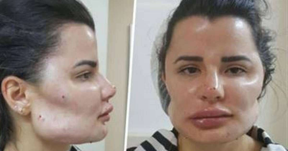 Адамдардың түрін құбыжыққа айналдырған хирургті сотқа берді