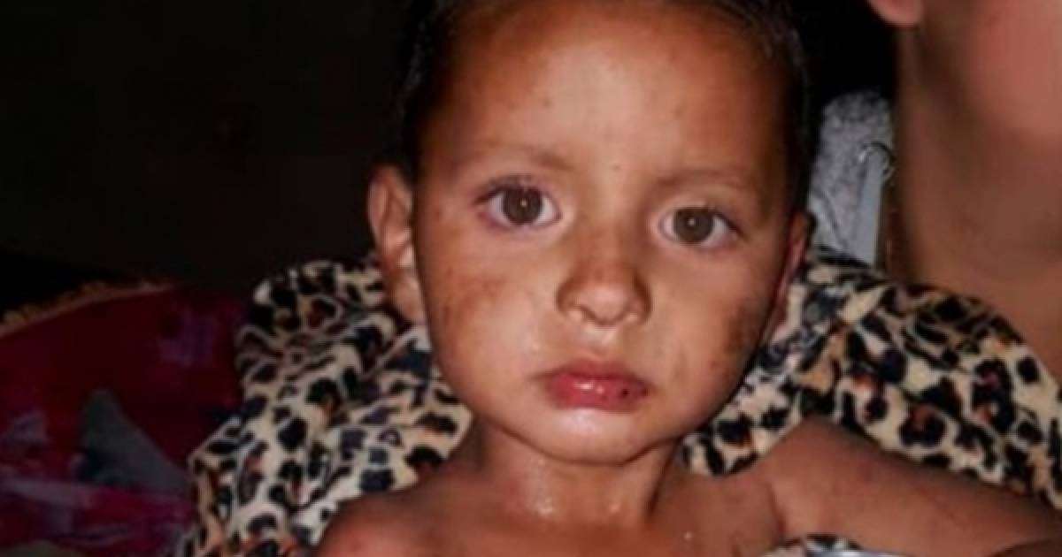 ​Екі жастағы бала бес күн бойы тауда ас-сусыз өмір сүрген