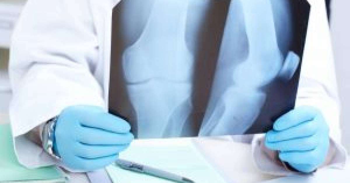 Сан зақымдалуы. | KazMedic