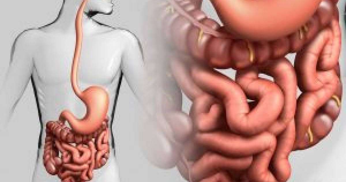 Тітіркенген ішек синдромы