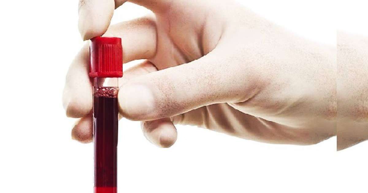 Түс жору: Түсінде қан көру. Қан түске кірсе ол нені білдіреді? • Түс Жору