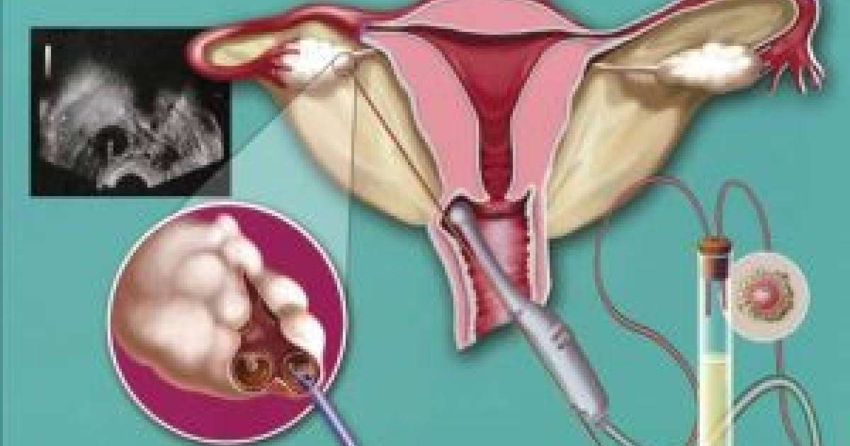 Инвазивті зерттеу әдістері