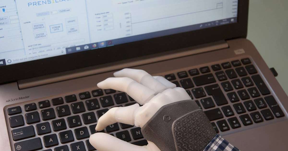 Ғалымдар алғаш рет қол протезін адам жүйкесіне тікелей жалғады - Қызықты деректер / Пайдалы мәліметтер - Bilim