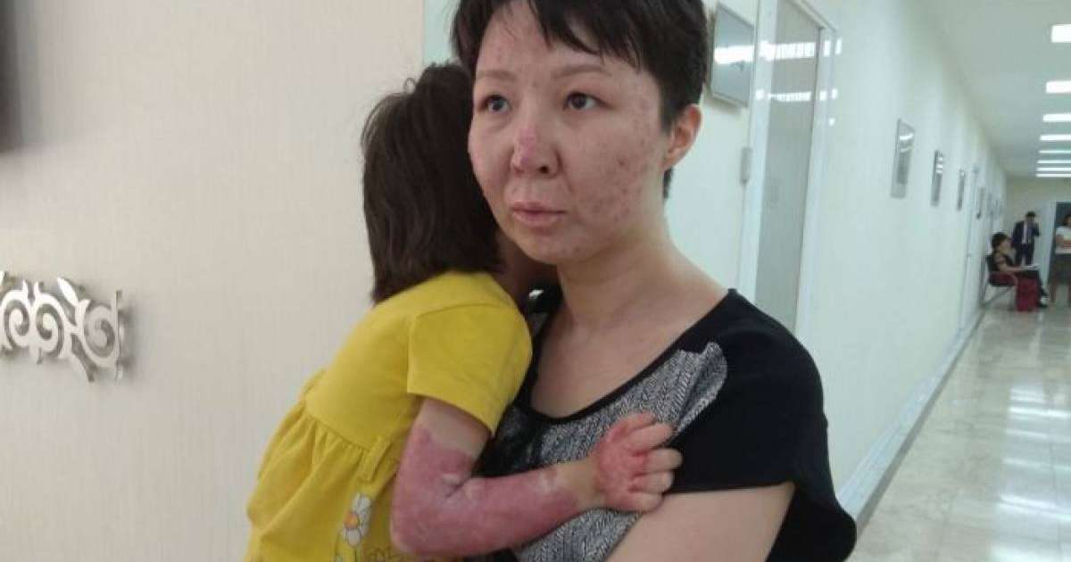 Ата-анасынан айырылып, мүгедек болып қалды: павлодарлық әйелдің жантүршігерлік оқиғасы