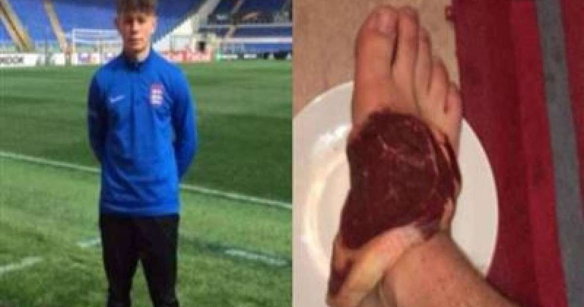 Футболшы командаласын шикі етпен емделуге мәжбүрлеген