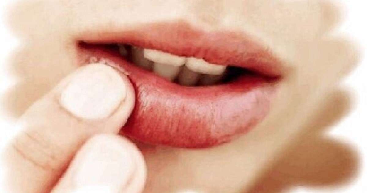 Еріндегі ұшықты қалай емдейді? |