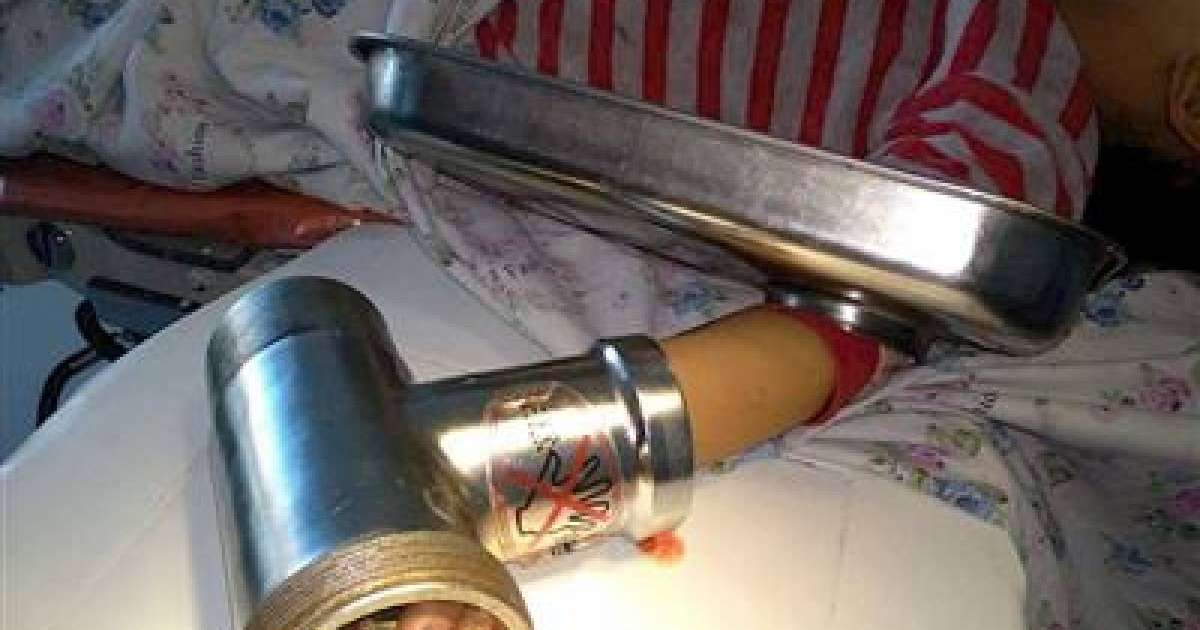 Ет турағыш машина сәбидің саусақтарын жұлып кетті