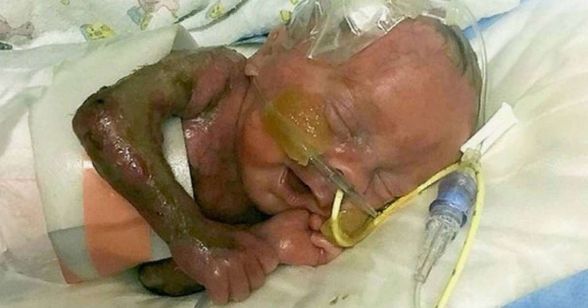 Терісі жоқ бала дүниеге келді