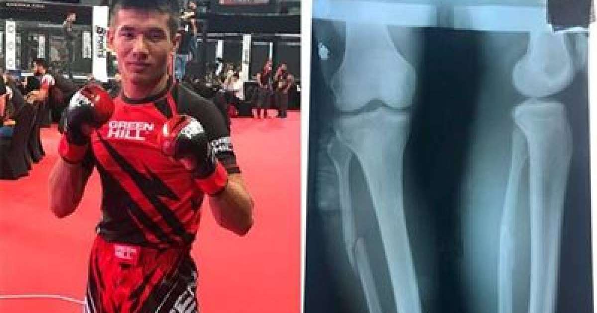 Қазақстандық спортшы сынған аяғымен жеңіске жетті