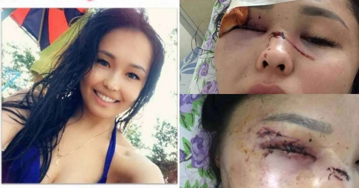 Қазақстанда ММА спортшысы қалыңдығын ұрып тастаған: Бикеш қоғамнан көмек сұрауда