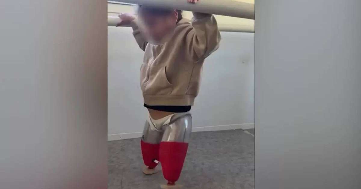 Астанада қос бірдей аяғынан айырылған Алуа протезбен алғашқы қадамын жасады (ВИДЕО)