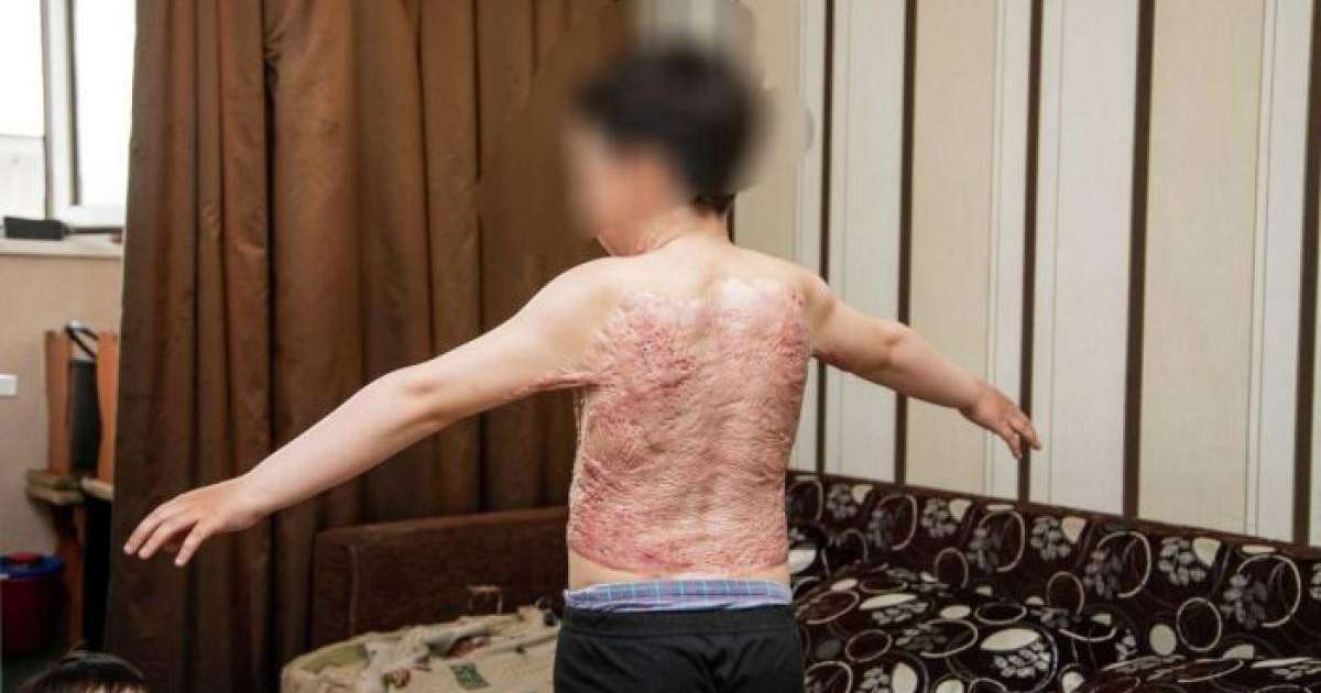 Үйде ешкім болмаған: елордалық баланың ауыр тағдыры елдің назарын аударды