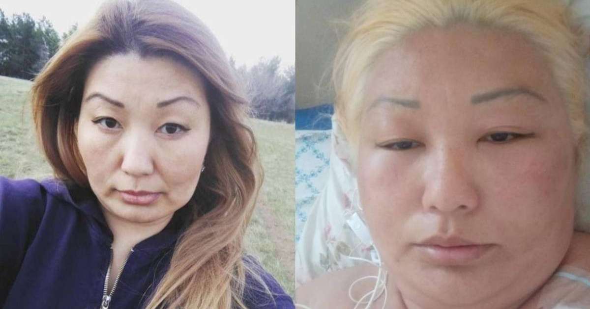 Оралда салонда шашын боятқан әйел аурухананың жансақтау бөлімінен бір-ақ шықты