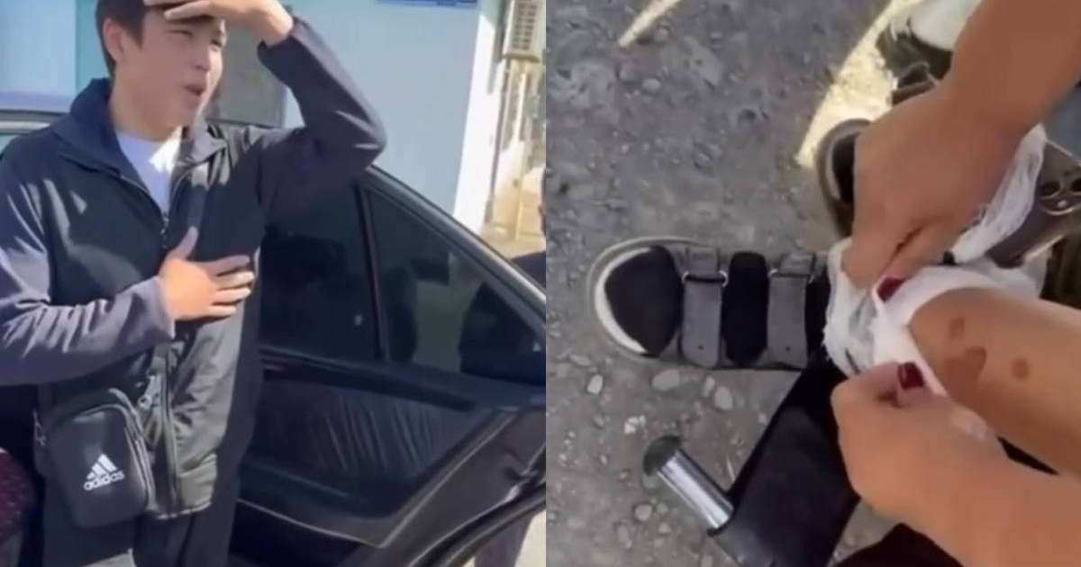 Мүгедек баланың аяғын әдейі күйдіріп қорлаған жасөспірімдер жұрт ашуын туғызды