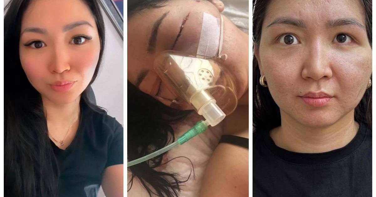 Балаларының көзінше 25 рет ұрған: Сот әйелінің бас сүйегін сындырған астаналықтың жазасын жеңілдетіп, бостандыққа шығармақ