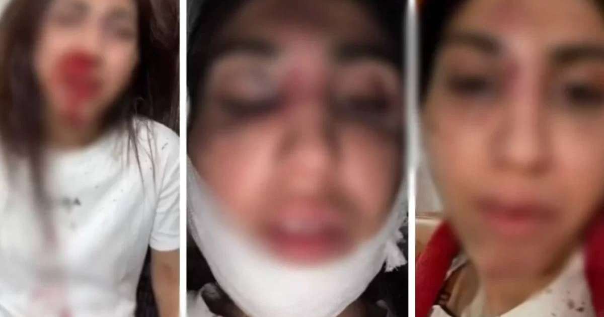 Балаларының көзінше жағы мен мұрнын сындырған: Бұрынғы күйеуінен таяқ жеген әйел Президенттен көмек сұрады