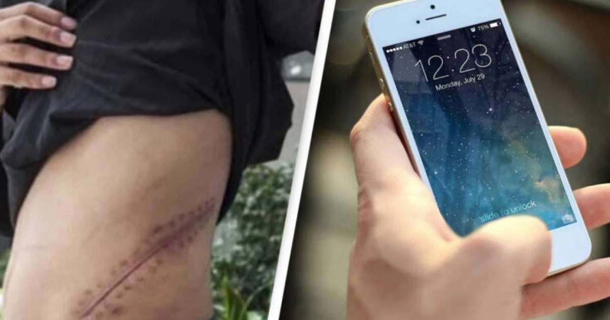 Енді төсек тартып жатыр: Жасөспірім iPhone үшін бүйрегін сатты