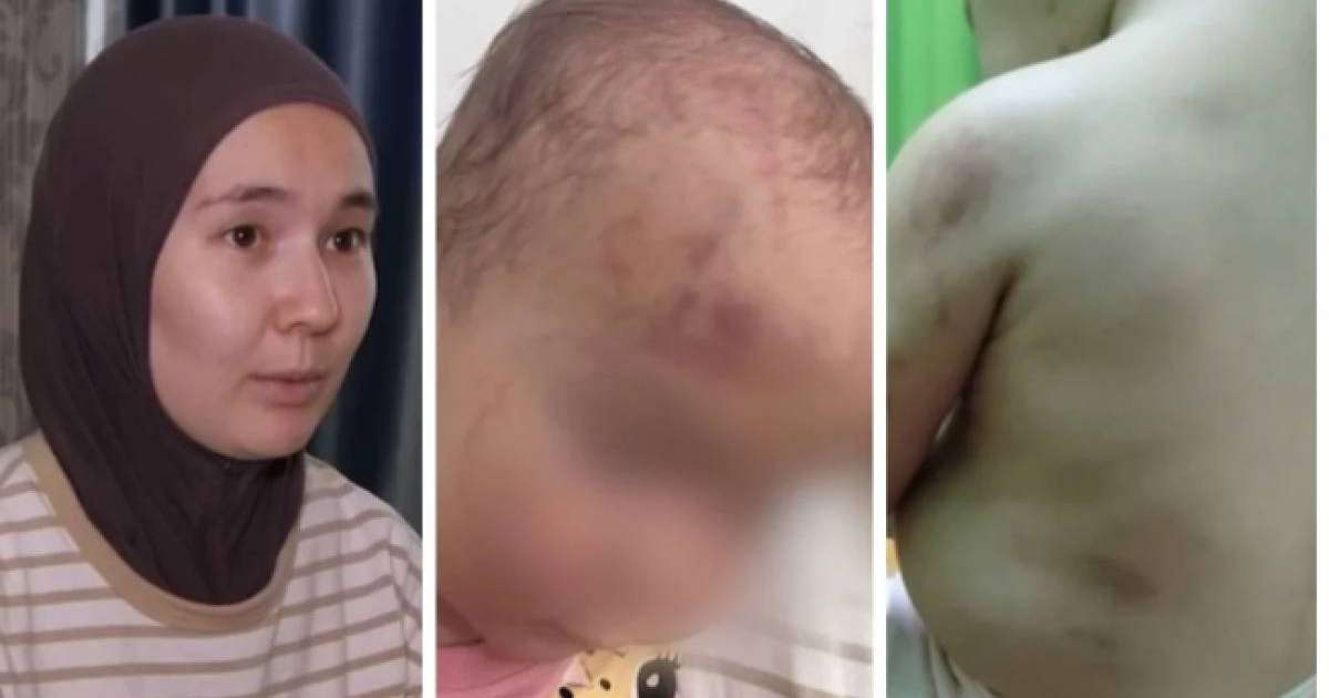 Ақтауда балабақшада бүлдіршінді қатарластары ұрып-соққан