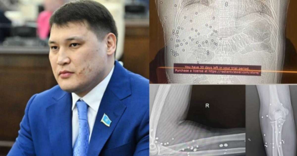 "Асфальтта құлап, дұға оқып жатты": Берденовке жасалған қастандықты көзімен көргендер куәлік етті