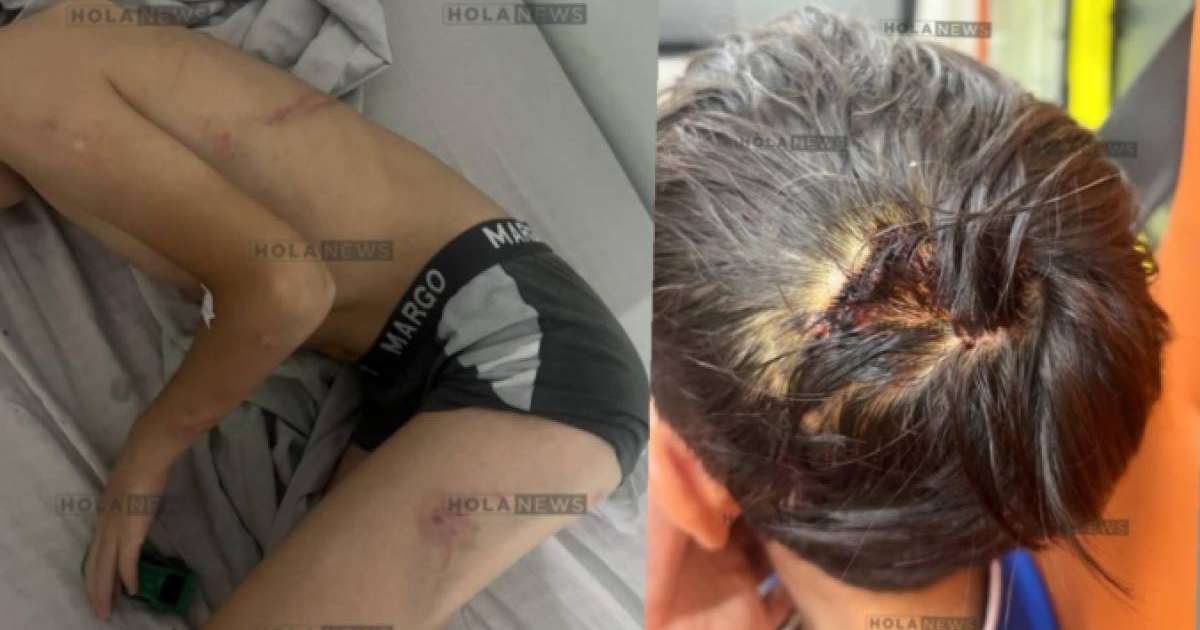 «Қазақмыс» қызметкері азаптаған 8 жасар баланың анасы көмек сұрады