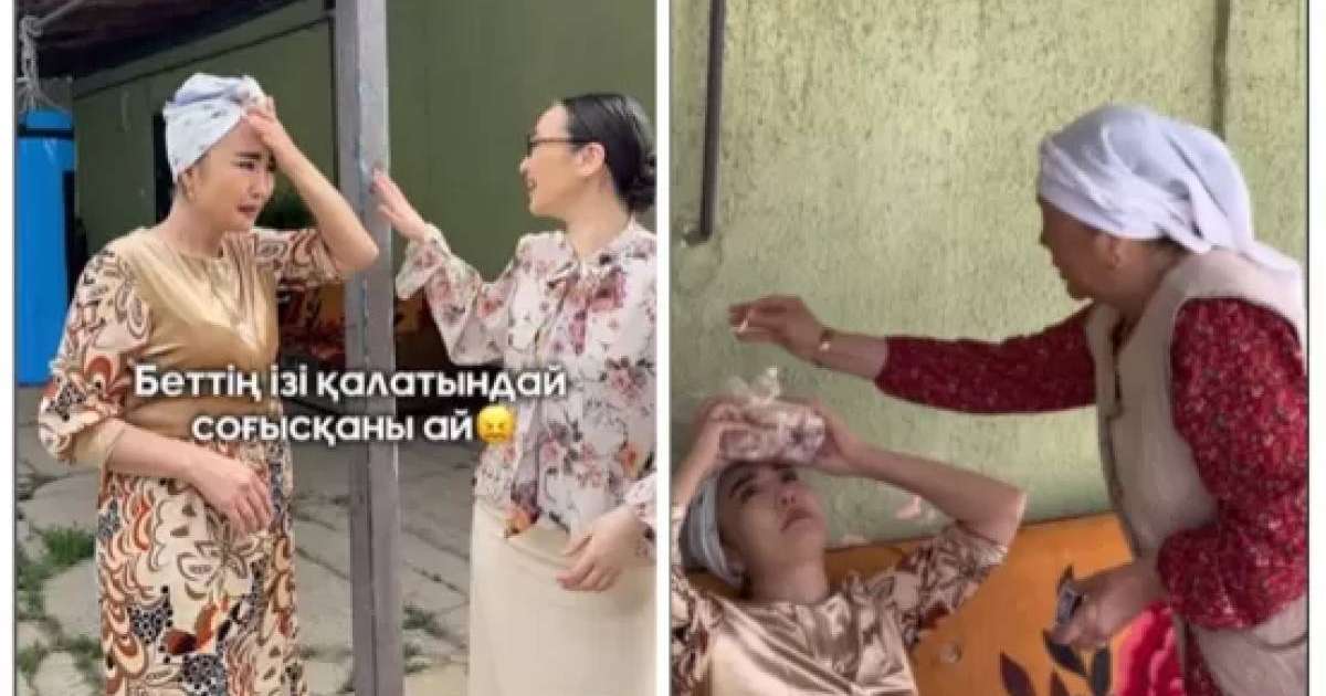 "Бағанға соғылды": "Балқия" есімімен танылған актриса Нұргүл Мыңғатова түсірілім алаңында жарақат алды