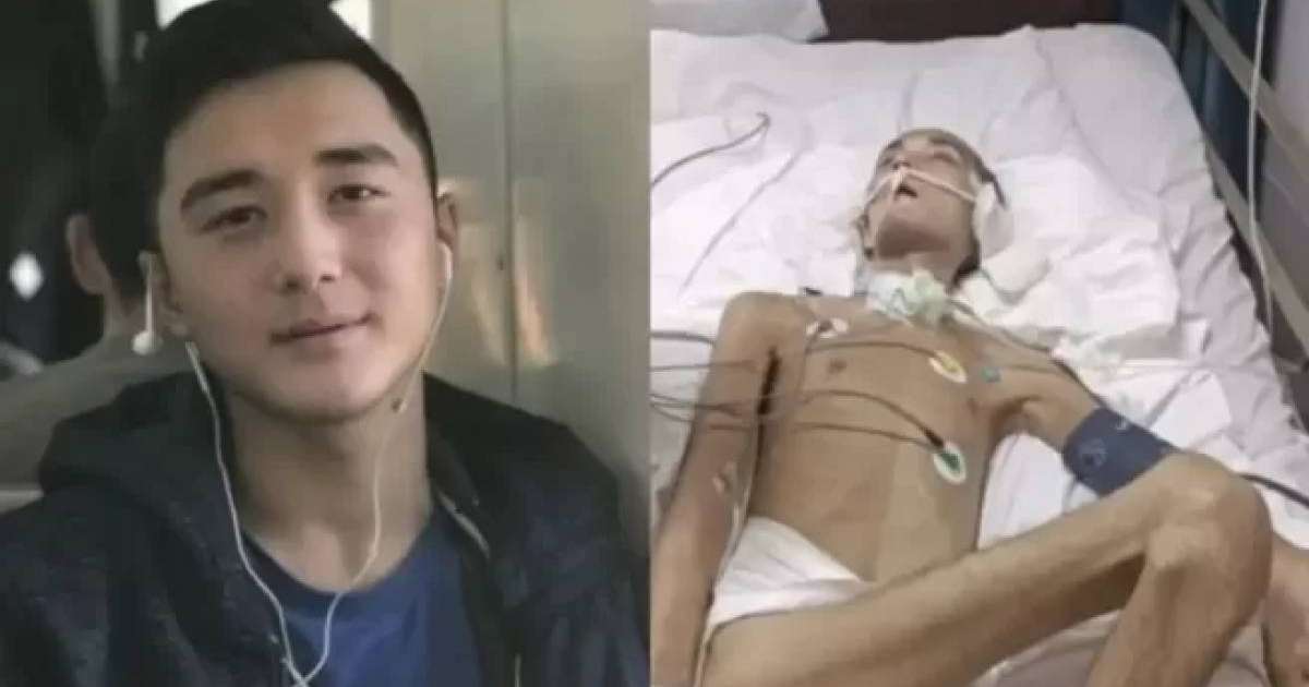 Түркиядан оралған Ербаян Мұхтарды қазақстандық дәрігерлер аяққа тұрғыза ала ма – министрдің жауабы