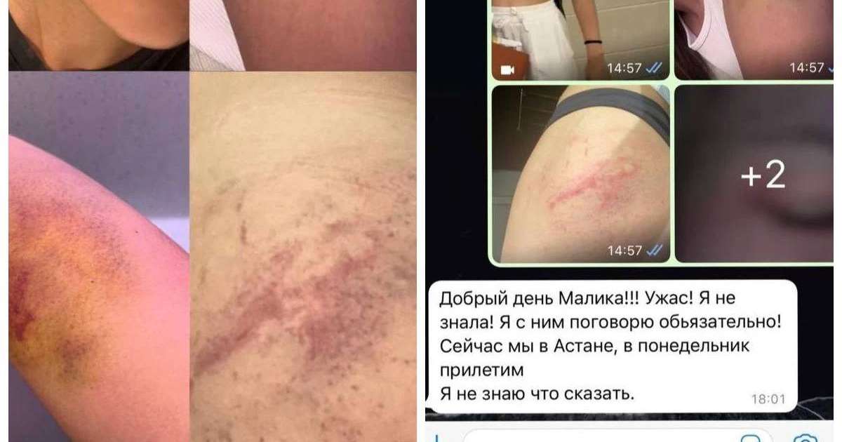 "Соққыға жығып, соңынан аңдыған": Алматылық қызды ұрып-соққан әкімдік қызметкері жұмысынан босатылды