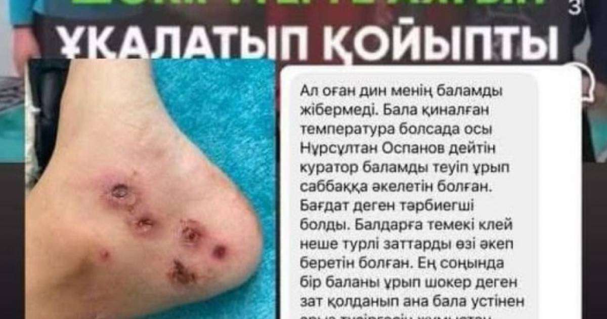 «Электрошокер, дедовщина»: Журналист Ораз Әлімбек Смановтар медресесіне қатысты тағы бір сұмдық жайттың бетін ашты