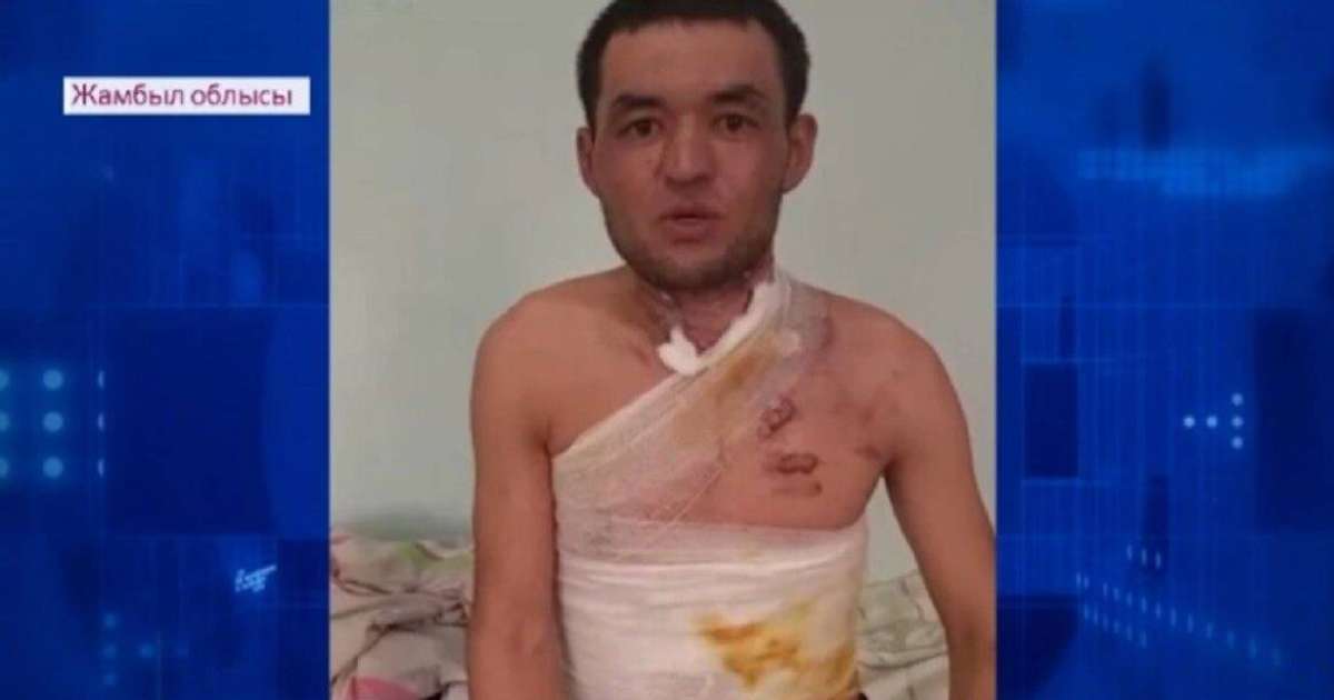 Полициядан қысым көргенін айтқан Жамбыл облысының тұрғыны өзін өртеп жіберді