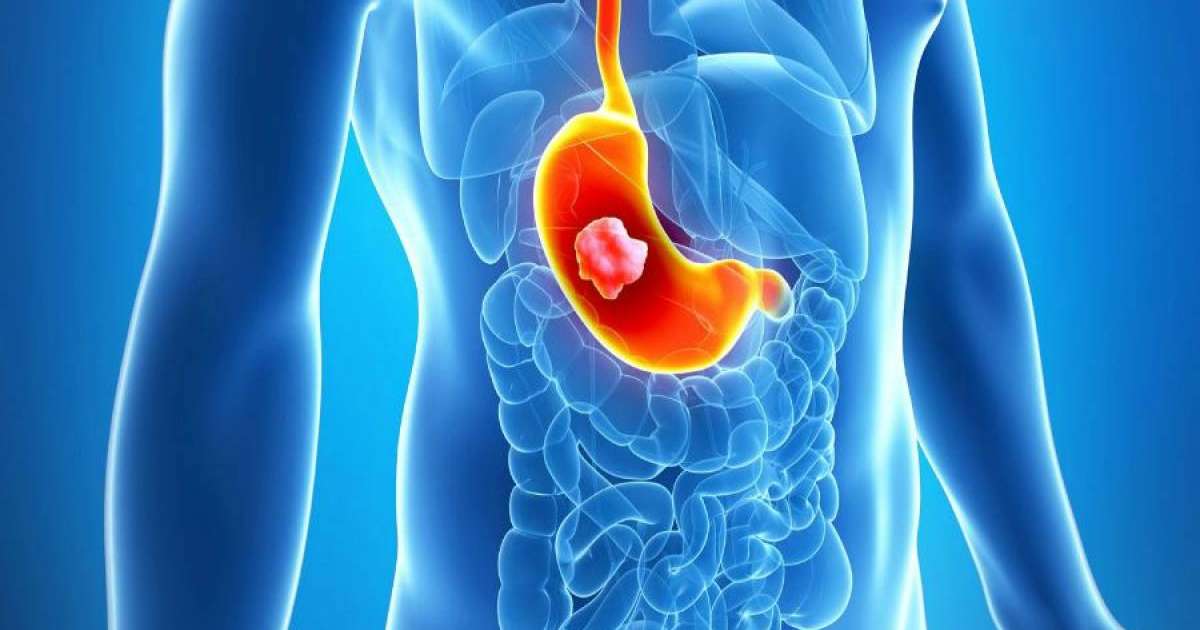 Асқазан туралы қазақша: қызметі мен құрылысы