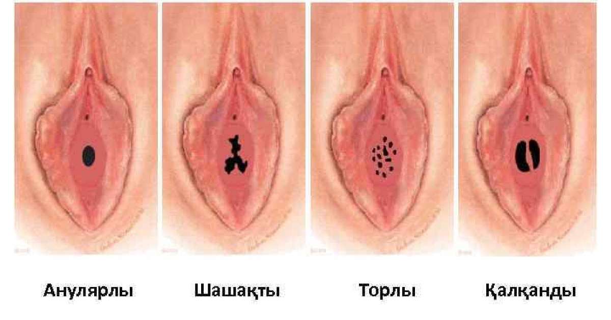 Ерлі-зайыптылар Сочи мен Дагомыста жыныстық қатынасқа серіктес іздейді. Порно актер жыныс мүшесін үлкейтіп жіберді.