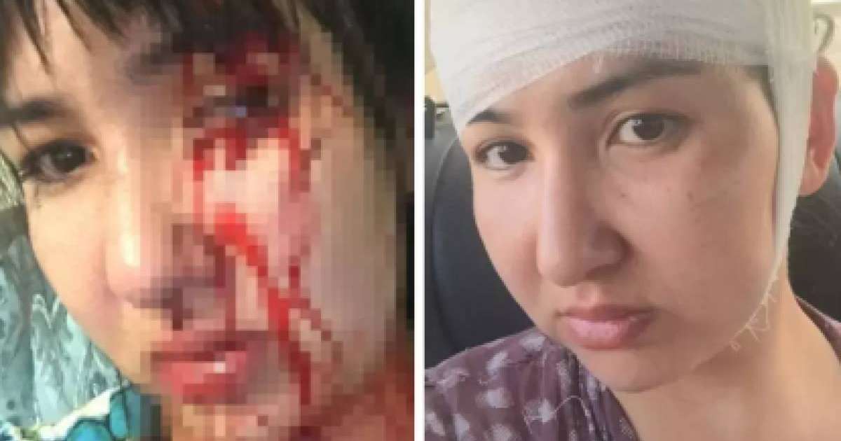 «Бетіме түкіріп, тізерлеп отырғызды». Атыраулық әйел бұрынғы депутат күйеуі 12 жыл бойы қорлағанын айтты