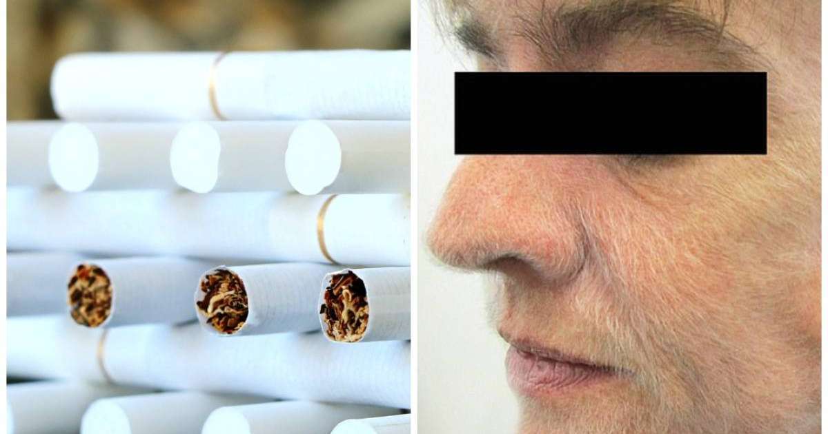 37 жыл шылым шеккен әйелді түк басқан