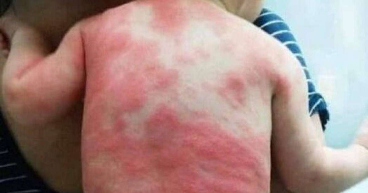 "Вакцина салған соң" түсірілген сурет қазақстандықтарды шошытты