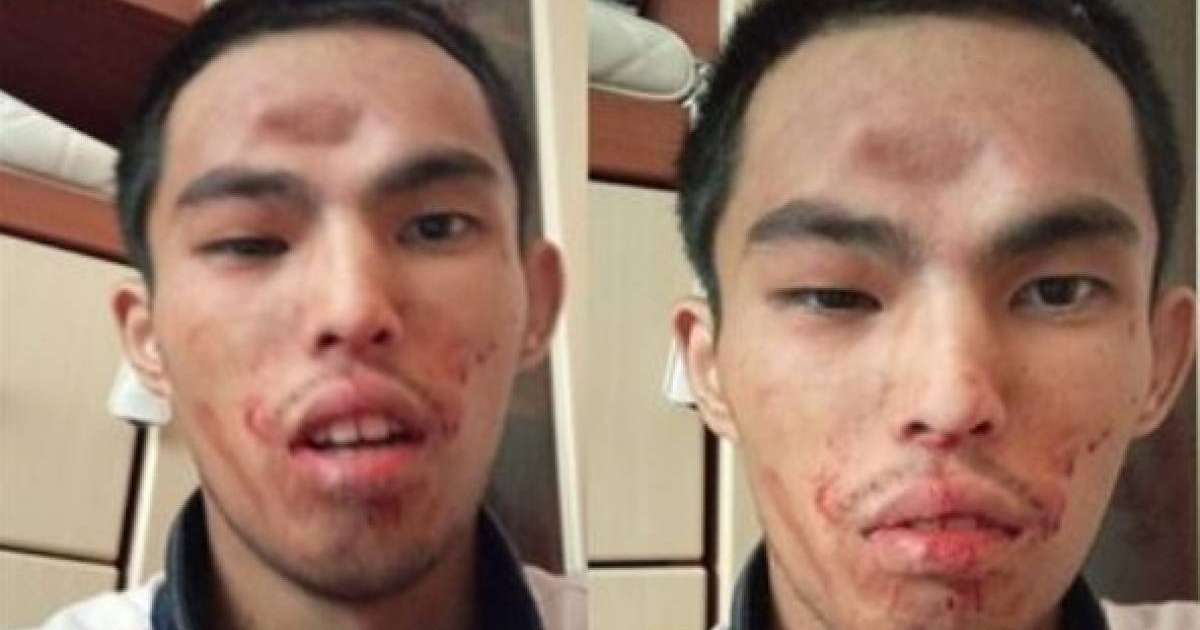 Алматыда әкесі баласын намаз оқымағаны үшін әбден ұрып, жансақтау бөлімінен бір-ақ шығарған