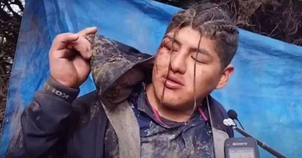 Тірідей жерленген ер адам көрден өздігінен шыққан (Фото)