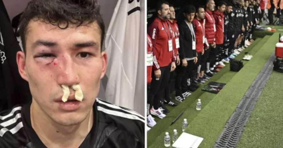 Қазақстандық футболшы Бақтияр Зайнутдинов ауыр жарақат алып, ауруханаға түсті