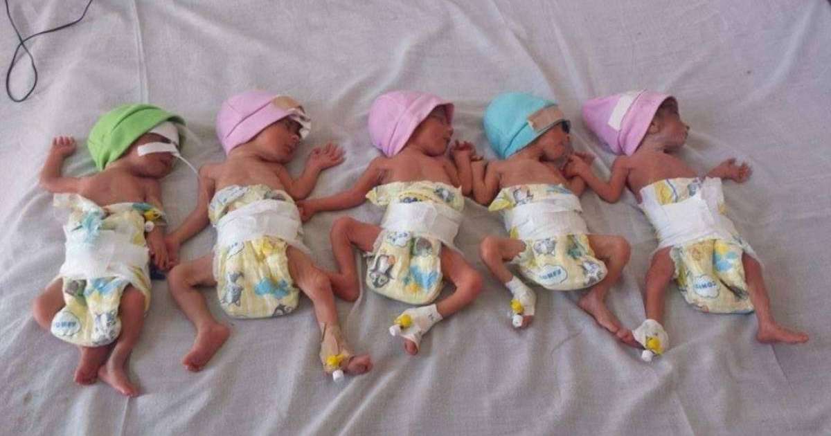 Үшінші перзентін күтіп жүрген әйел бірден 5 бала туды