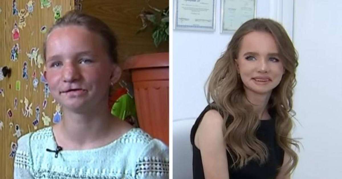 Туыстары келбетін жарақаттаған алматылық қыз адам танымастай өзгерді