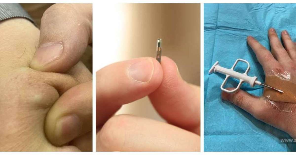 Чип салдырған бірінші қырғызстандық атанған жігіт тәжірибесімен бөлісті