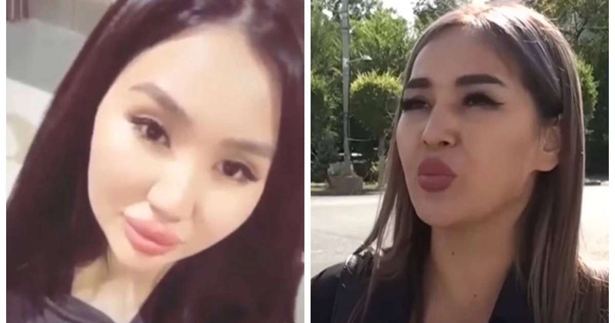 "Адам емессіңдер, жауап бересіңдер дейді": Таразда арнайы білімсіз ота жасап, сотталған косметолог жәбірленушіге хабарласып қорқытып жүр