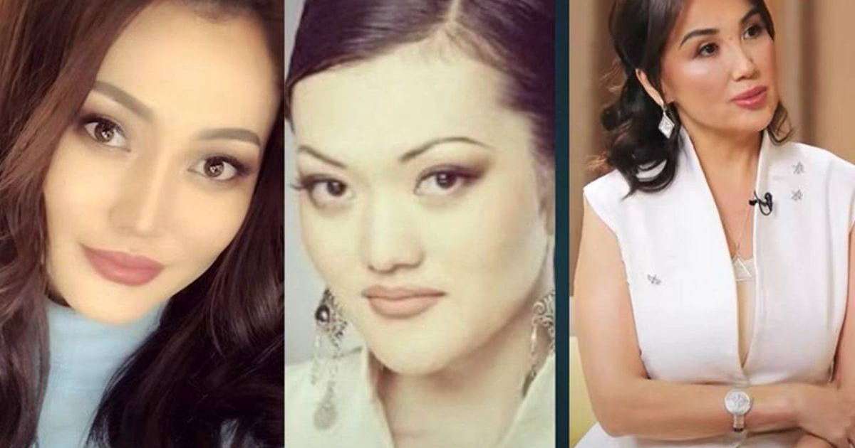 “Жақ сүйегін сындырған” - Ерке Есмахан пластикалық ота туралы айтты