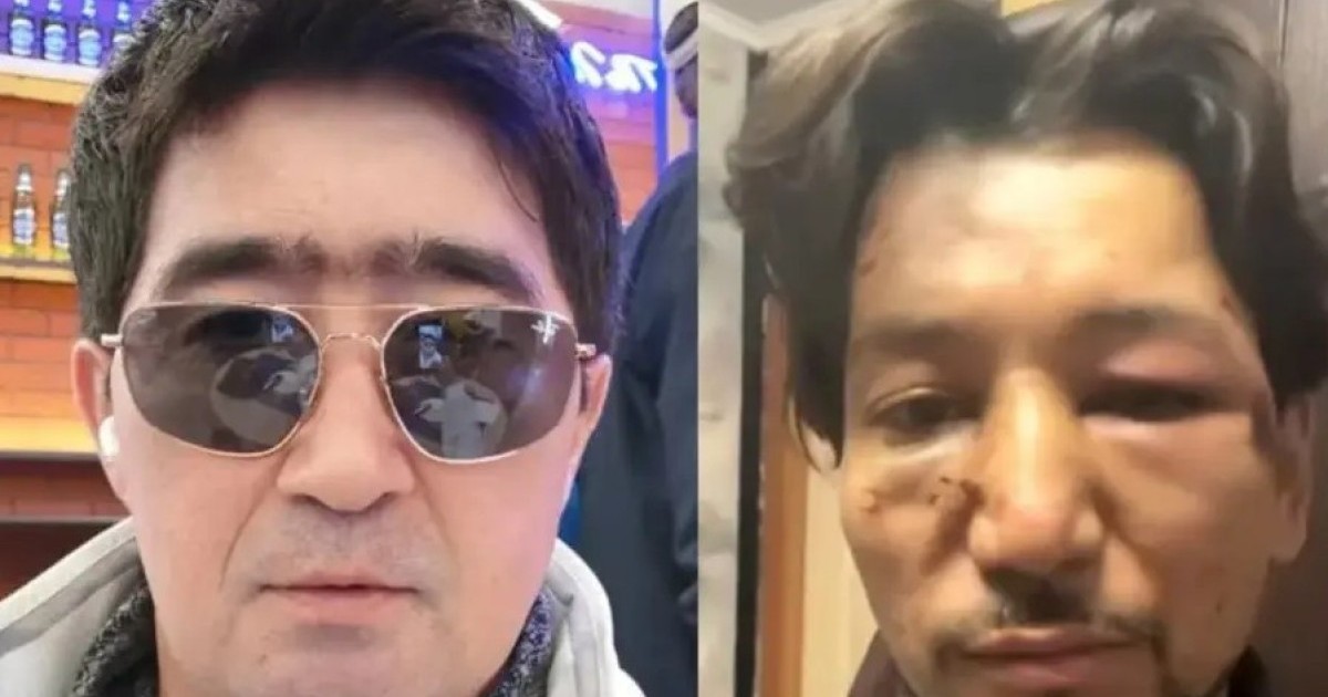 "Ғалымжанды есінен танығанша ұрған, оны алда операция күтіп тұр": Мұқасан Шахзадаевқа тықыр таянды