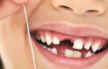 Сәбидің тісі тез шығу үшін