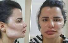 Адамдардың түрін құбыжыққа айналдырған хирургті сотқа берді