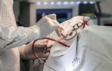 Бір отбасындағы үш адам қатерлі ісіктен қорқып, асқазанын алдырып тастады