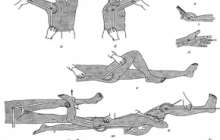 Буын қозғалғыштығын анықтау | KazMedic